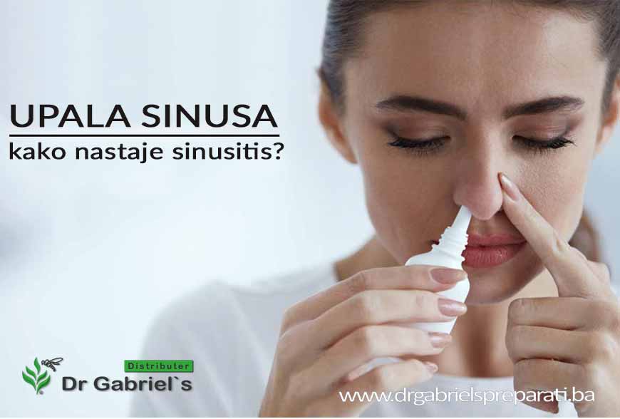 Upala sinusa i kako nastaje sinusitis?