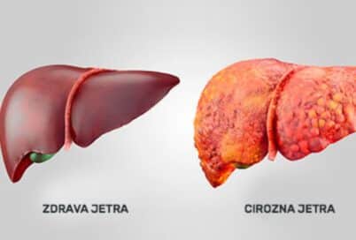 zdrava i masna jetra